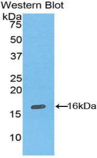 Polyclonal Antibody to Inhibin Alpha (INHa)