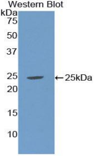 Polyclonal Antibody to Sex Hormone Binding Globulin (SHBG)