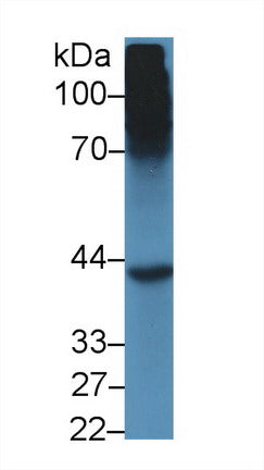 Polyclonal Antibody to Sex Hormone Binding Globulin (SHBG)