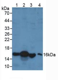 Polyclonal Antibody to Retinol Binding Protein 1, Cellular (RBP1)