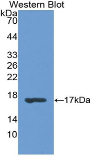 Polyclonal Antibody to Retinol Binding Protein 1, Cellular (RBP1)