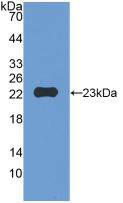 Polyclonal Antibody to Matrix Metalloproteinase 12 (MMP12)