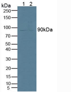 Polyclonal Antibody to Phospholipase A2, Calcium Independent (iPLA2)