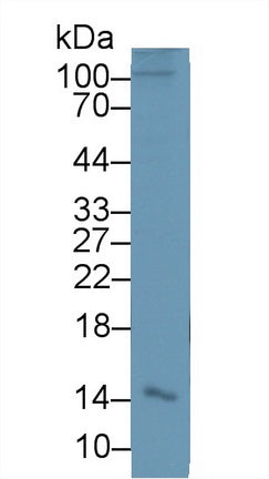 Polyclonal Antibody to Alpha-Hemoglobin Stabilizing Protein (aHSP)