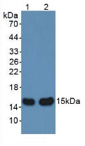 Polyclonal Antibody to Alpha-Hemoglobin Stabilizing Protein (aHSP)
