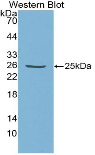 Polyclonal Antibody to Elastin Microfibril Interface Located Protein 1 (EMILIN1)