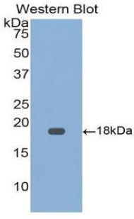 Polyclonal Antibody to Growth Differentiation Factor 9 (GDF9)