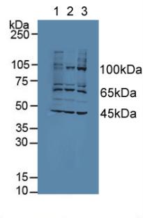 Polyclonal Antibody to Apoptosis Associated Tyrosine Kinase (AATK)