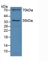 Polyclonal Antibody to Sirtuin 2 (SIRT2)