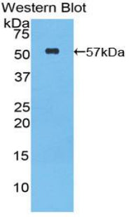 Polyclonal Antibody to Granzyme M (GZMM)