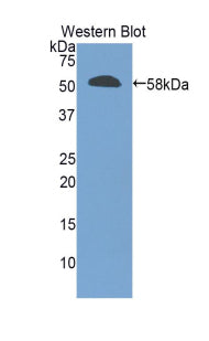 Polyclonal Antibody to Granzyme M (GZMM)