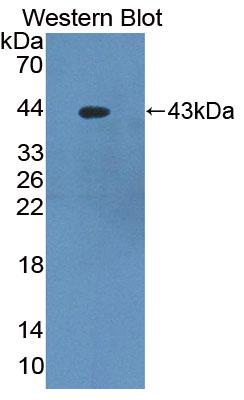 Polyclonal Antibody to Protein Kinase C Delta (PKCd)