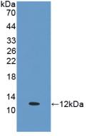 Polyclonal Antibody to Estrogen Receptor Beta (ERb)