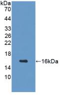 Polyclonal Antibody to Growth Hormone Releasing Hormone (GHRH)