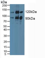 Polyclonal Antibody to Protein Kinase C Epsilon (PKCe)