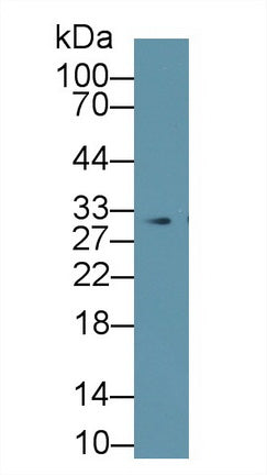 Polyclonal Antibody to Prohibitin (PHB)