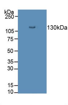 Polyclonal Antibody to Desmoglein 3 (DSG3)