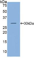 Polyclonal Antibody to Kallikrein 5 (KLK5)