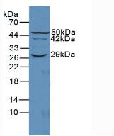 Polyclonal Antibody to Cluster Of Differentiation 55 (CD55)