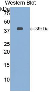 Polyclonal Antibody to Osteocalcin (OC)