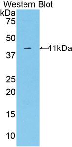 Polyclonal Antibody to Osteocalcin (OC)