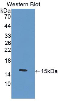 Polyclonal Antibody to Calcitonin (CT)