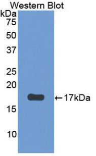 Polyclonal Antibody to Parathyroid Hormone Receptor 2 (PTHR2)