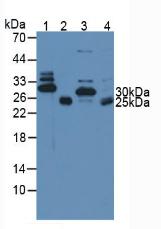 Polyclonal Antibody to Cardiac Troponin I (cTnI)