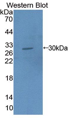 Polyclonal Antibody to Cardiac Troponin I (cTnI)