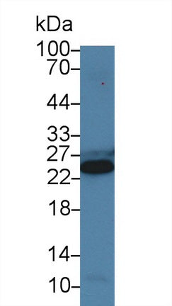 Polyclonal Antibody to Cardiac Troponin I (cTnI)