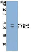 Polyclonal Antibody to Endothelin 1 (EDN1)