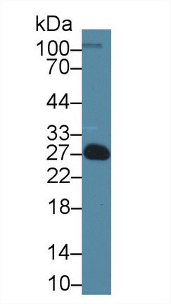 Polyclonal Antibody to Endothelin 1 (EDN1)