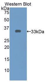 Polyclonal Antibody to Endothelin Converting Enzyme 1 (ECE1)