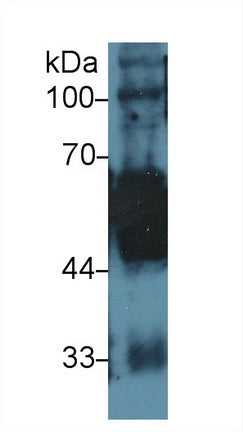 Polyclonal Antibody to Cytokeratin 5 (CK5)