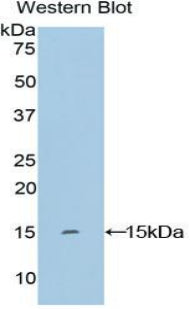 Polyclonal Antibody to Keratin 2 (CK2)