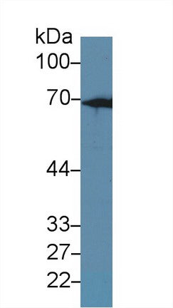 Polyclonal Antibody to Keratin 2 (CK2)