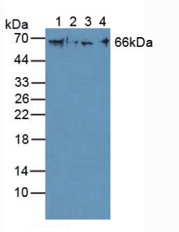 Polyclonal Antibody to Cytokeratin 1 (CK1)