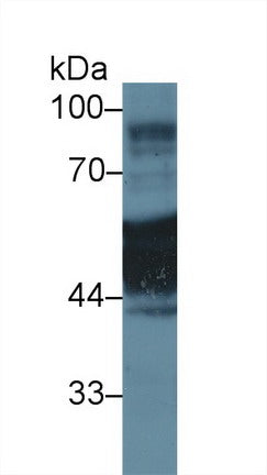 Polyclonal Antibody to Cytokeratin 1 (CK1)