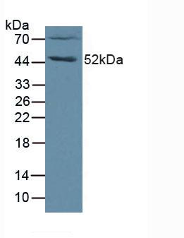 Polyclonal Antibody to Fibrinogen Like Protein 2 (FGL2)