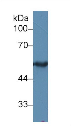 Polyclonal Antibody to Cytokeratin 15 (CK15)