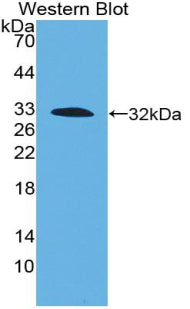 Polyclonal Antibody to Tissue Factor (TF)