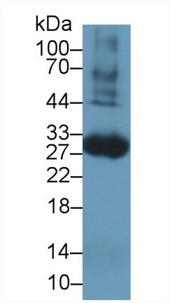 Polyclonal Antibody to Tissue Factor (TF)