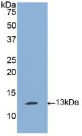 Polyclonal Antibody to Tissue Plasminogen Activator (tPA)