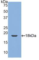 Polyclonal Antibody to Thrombomodulin (TM)