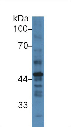 Polyclonal Antibody to Plasminogen Activator Inhibitor 2 (PAI2)