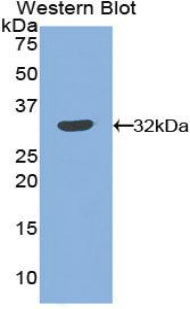 Polyclonal Antibody to Plasminogen Activator Inhibitor 2 (PAI2)