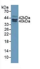 Polyclonal Antibody to Plasminogen Activator Inhibitor 2 (PAI2)