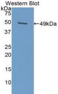 Polyclonal Antibody to Plasminogen Activator Inhibitor 1 (PAI1)