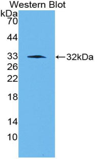 Polyclonal Antibody to Plasminogen Activator Inhibitor 1 (PAI1)