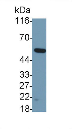 Polyclonal Antibody to Leucine Aminopeptidase (LAP)